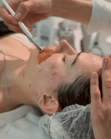 Simona Baroncini, Mio Dermoestetica